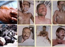 مدعیان حقوق بشر طرفدار  بکار بردن سلاح های شیمیایی هستند/35 هزار جانباز سهم ایران از جنگ تحمیلی