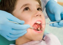 ارائه خدمات دندانپزشکی در کلینیک ويژه تخصصی وحدت ايرانشهر
